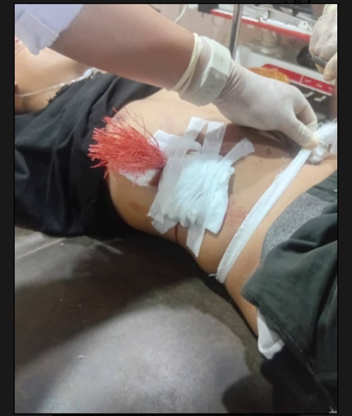 Dua Pemuda Asal Mangge Asi Jadi Korban Serangan Panah Rabu Malam, 24 Juni 2026.
